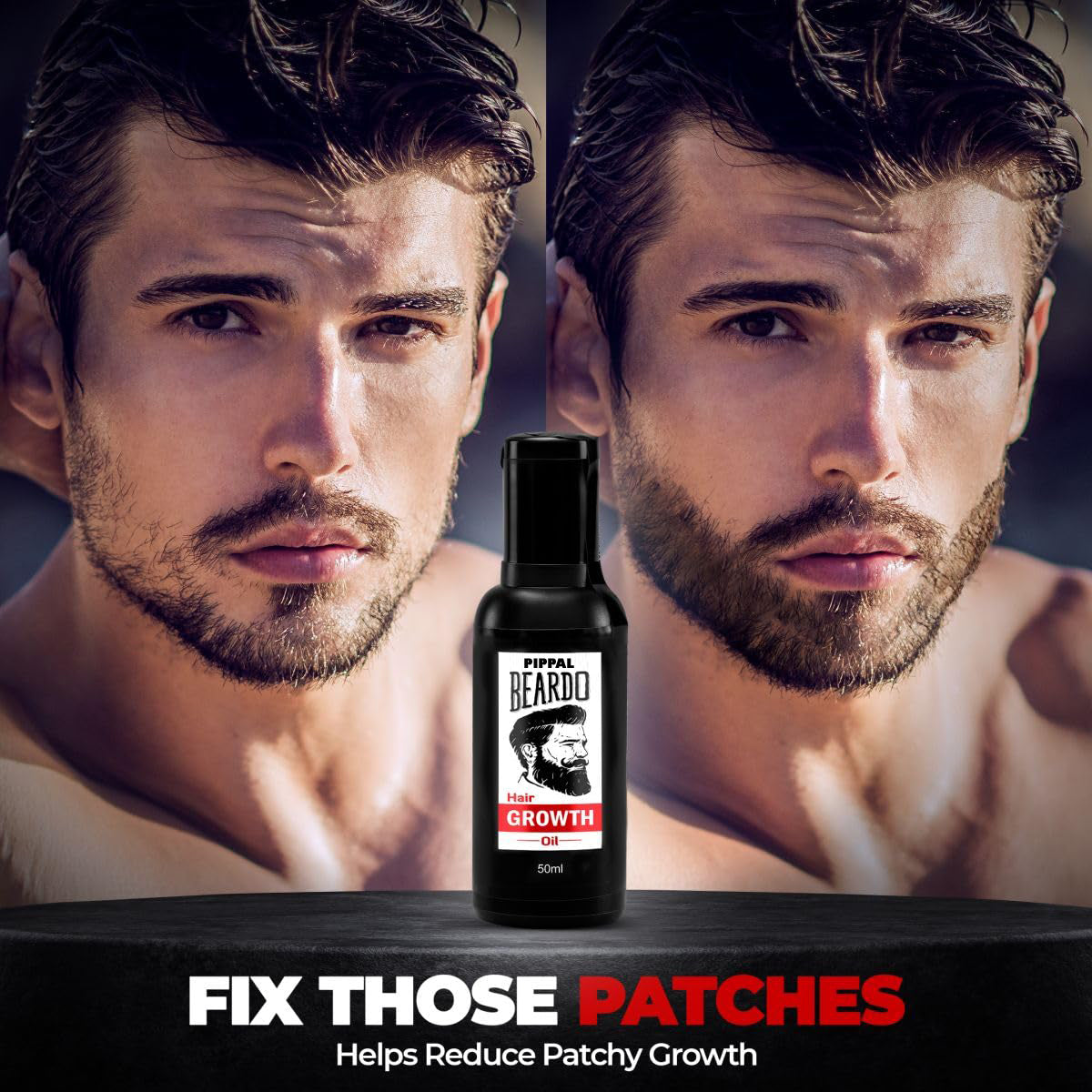 Beard And Hair Growth Oil - (Fast Growth)